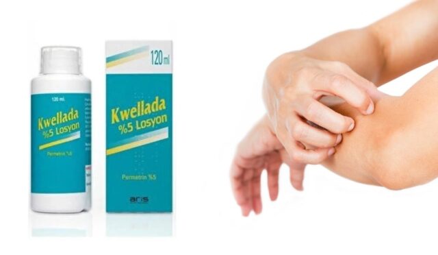 Kwellada Losyon Nedir
