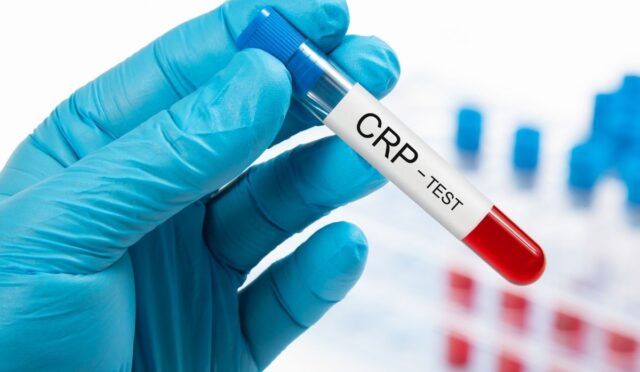 CRP Nasıl Düşer? CRP Düşüren Yiyecekler Nelerdir?