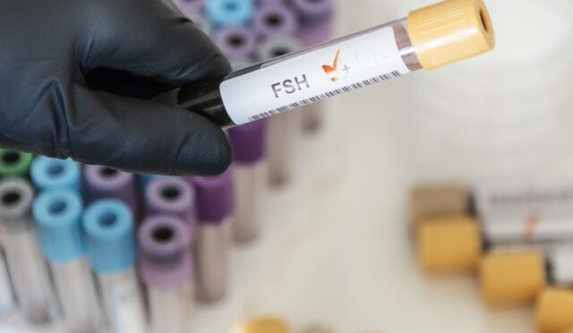 FSH Nasıl Düşer? FSH Düşürmek İçin Ne Yapmalısınız?