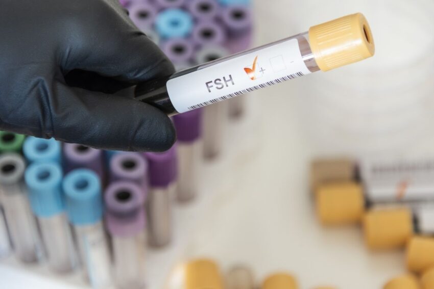 FSH Nasıl Düşer? FSH Düşürmek İçin Ne Yapmalısınız?