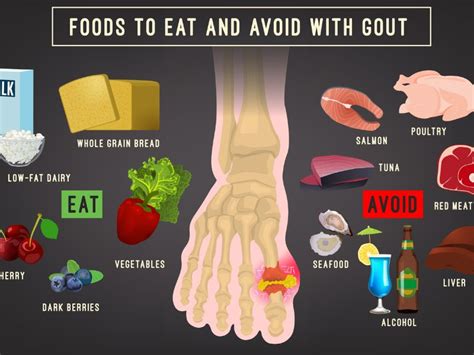 Gut Hastalığı için Beslenme Önerileri
