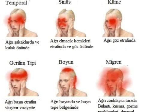 Kaş Beyazlaması: Sebepleri ve Çözüm Önerileri