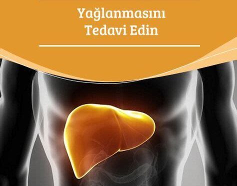 Karaciğer Yağlanması Nasıl Tedavi Edilir?