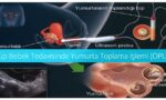 Tüp Bebek İçin Yumurta Nakli