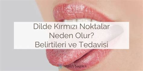 Dilde Kırmızı Noktalar/Kabarcıklar: Neden Olur? Belirtileri ve Tedavisi
