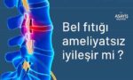Bel Fıtığı Nedir? Belirtileri, Tedavisi ve Egzersizleri