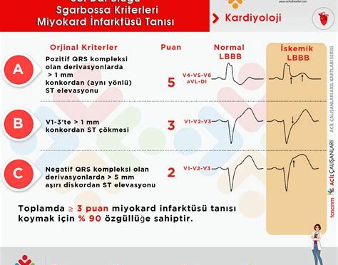 Kalp Krizi (Miyokart İnfarktüsü) Belirtileri ve Acil Müdahale
