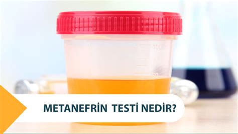 Metanefrin Testi Nedir? Normetanefrin Neden Yapılır?