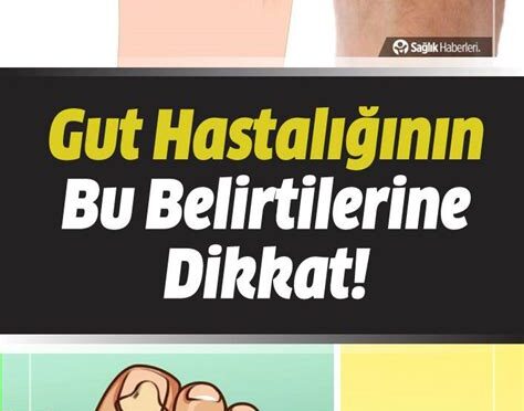 Gut Hastalığı ve Belirtileri