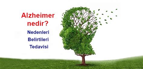 Alzheimer Hastalığı Belirtileri ve Tedavi Seçenekleri