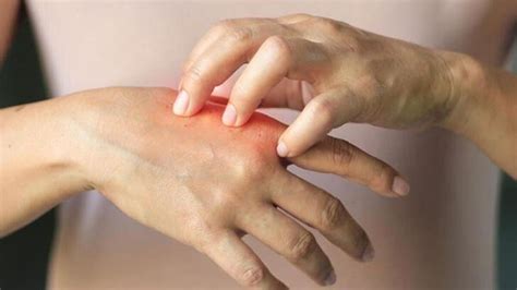 Doğal Yöntemlerle Tedavi Edilmesi Mümkün Olan Hastalıklar