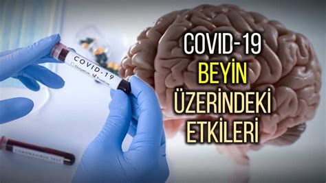 Nootropik İlaçların Beyin Üzerindeki Etkileri